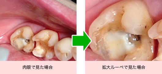 大崎オーバルコート歯科・矯正歯科室の一般歯科