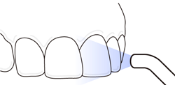 大崎オーバルコート歯科・矯正歯科室のホワイトニング