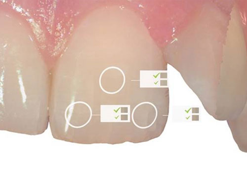 大崎オーバルコート歯科・矯正歯科室の口腔内スキャナ 3SHAPE TRIOS 3