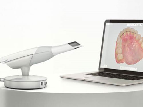 口腔内スキャナ 3SHAPE TRIOS 5 - 大崎・五反田の歯医者｜痛みに配慮