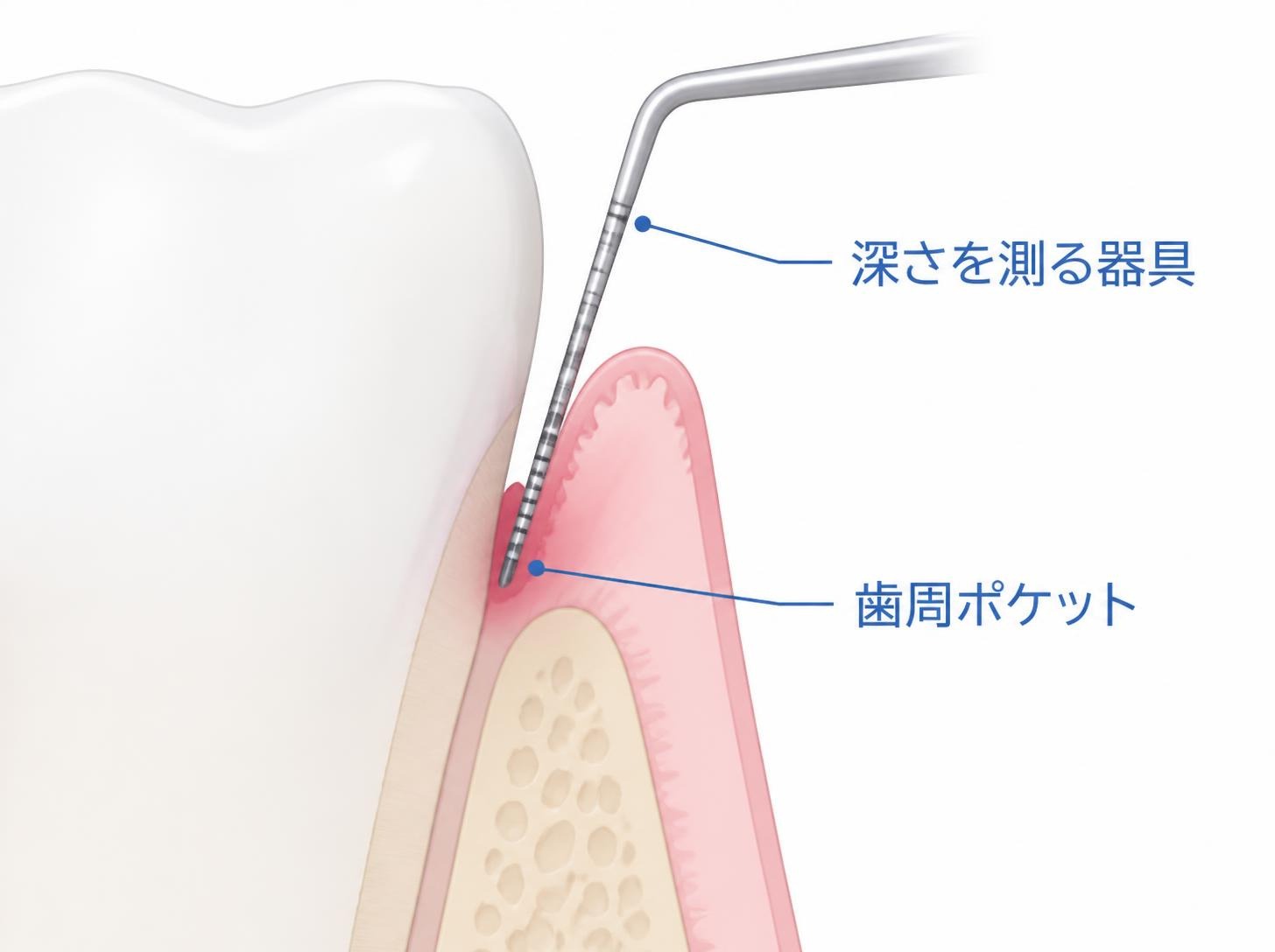 歯科での検査と対応