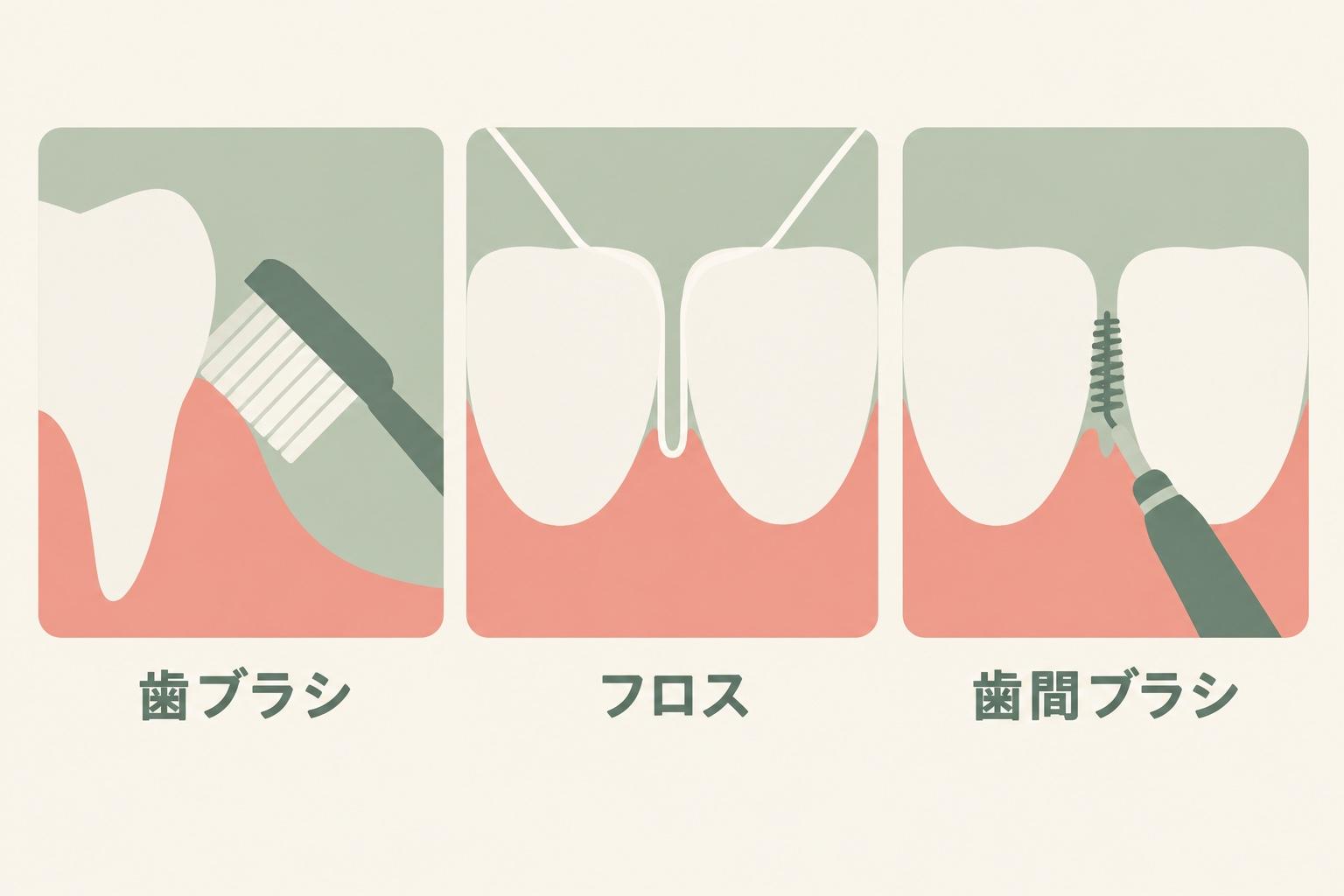 歯ブラシを歯ぐきのきわに斜めに当て、フロスと歯間ブラシを歯のすき間に通す図